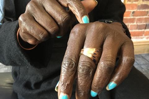 Two brown skin hands with aqua painted nails, one finger points to the top of the other hand.